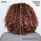 Acidic Bonding Concentrate Intensive Treatment